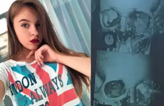 disparo-en-la-cara