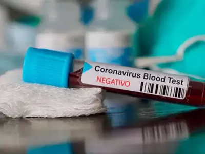 coronavirus-8