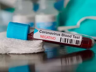 coronavirus-12