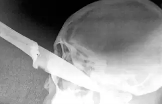cuchillo-ojo