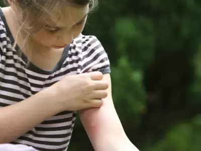 picadura-de-mosquito-dengue