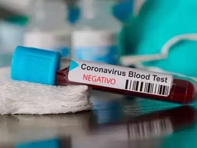 coronavirus-negativo-
