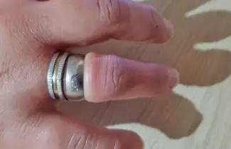 anillo-
