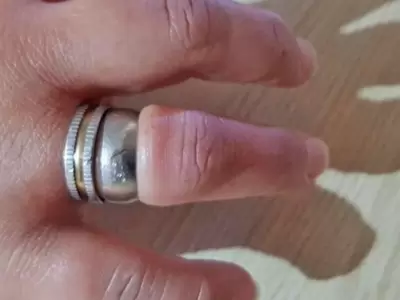 anillo-