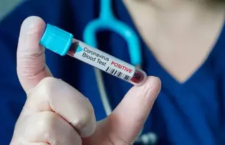 coronavirus-2