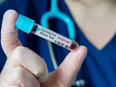 coronavirus-2