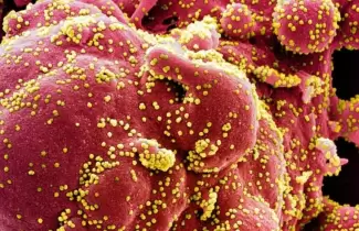 coronavirus-4