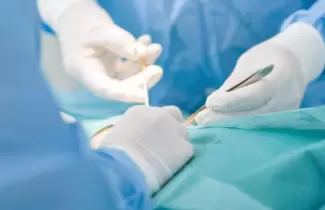 operacion
