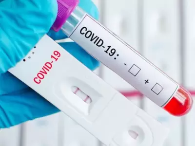 test-coronavirus-1
