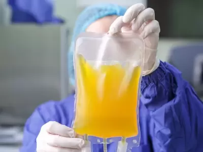 plasma