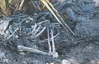 cuerpo-quemado