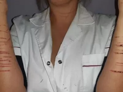 mujer-atacada