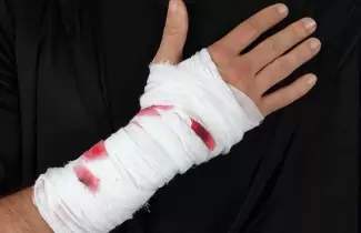 brazo-herido-alusiva