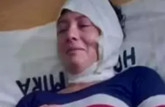 mujer-atacada-por-el-ex