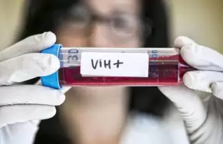 VIH-POSITIVO-