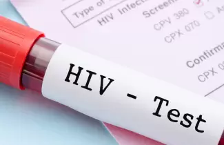test-VIH