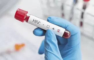 vhi-virus-de-inmunodeficiencia-humana-
