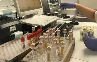 estudios-biquimicos-bioquimica-salud-jujuy-reactivos-insumos-