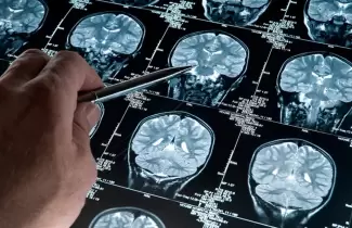 alzheimer-salud-mental
