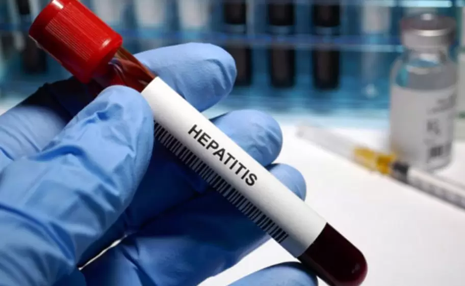 hepatitis-1