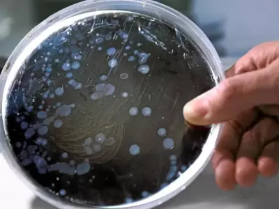 legionella-