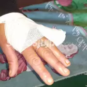 Libertador: un perro pitbull atacó a una mujer y le arrancó un dedo