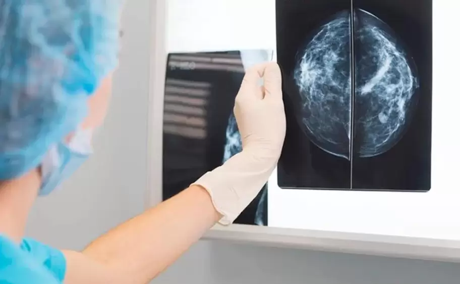 mamografia-estudio-cancer-mama