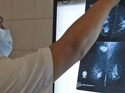 analisis-mamografia-