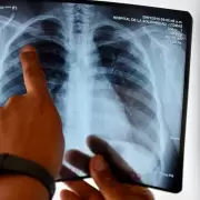 Jujuy actualizará al personal de salud sobre la detección temprana y tratamiento de la tuberculosis