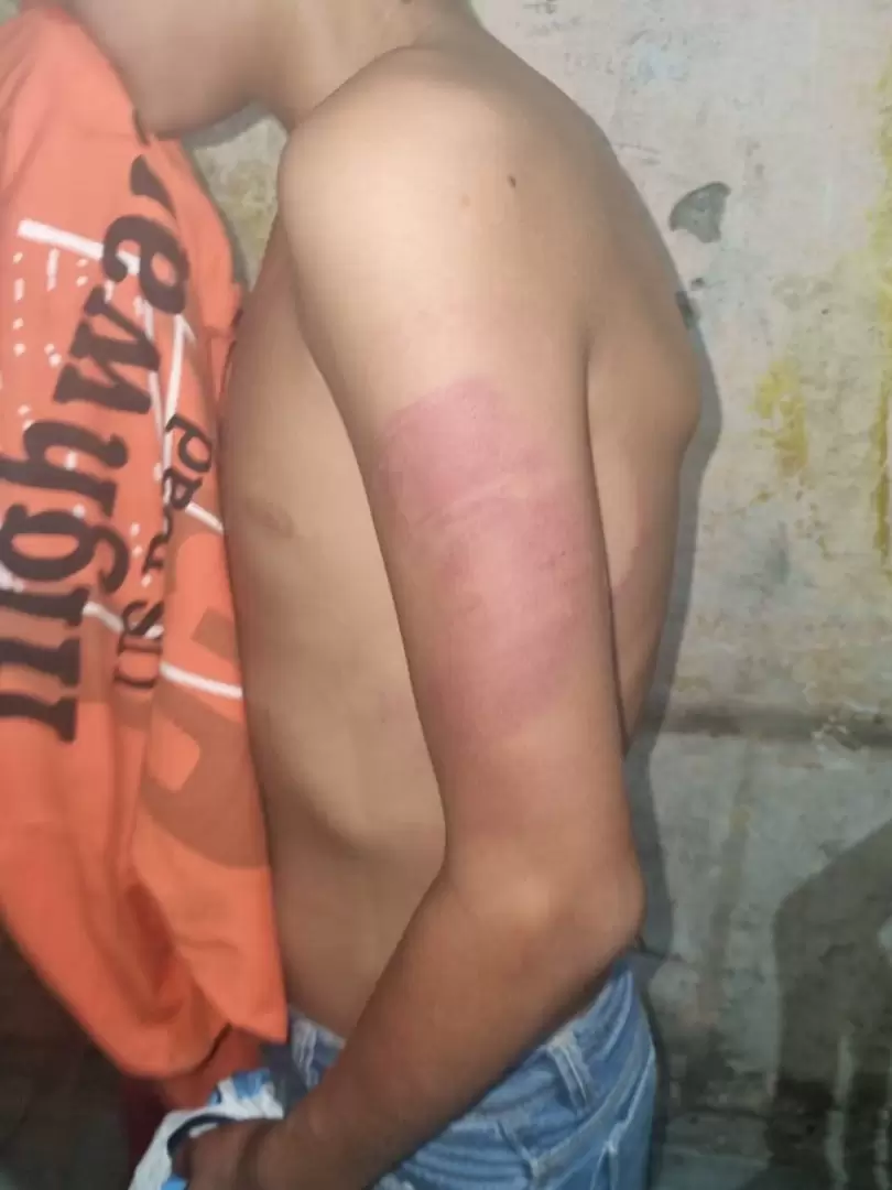 menor de 12 años agredido con un cinto en Libertador