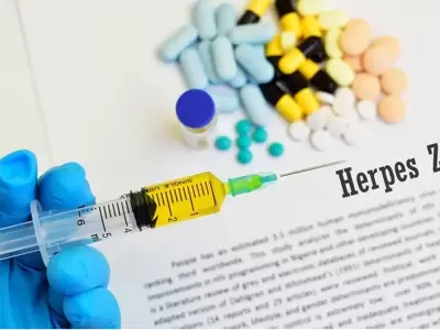 vacuna contra el herpes
