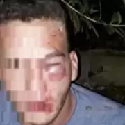 Un hombre pactó un encuentro con una nena de 12: la familia de ella lo engañó y lo desfiguró