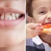 Caries dental y obesidad con las principales enfermedades en los menores de edad