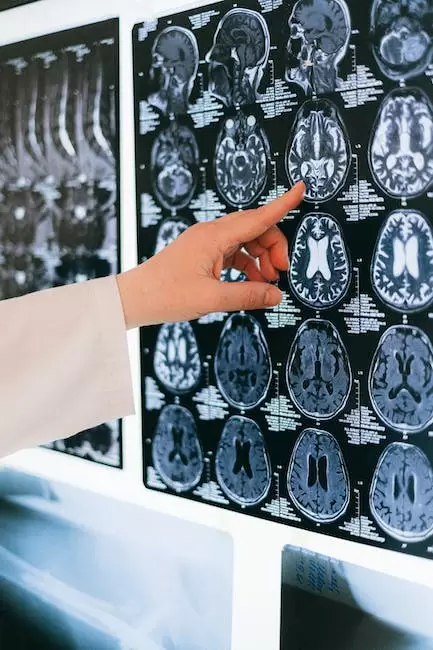 Cerebro