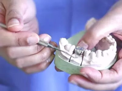 mecanico dental