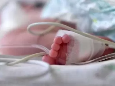 bebé - quemadura - hospital