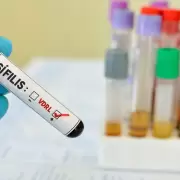 Preocupa el elevado aumento de casos de sífilis en Argentina