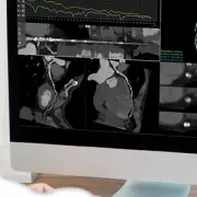 El Portal de Imágenes Médicas reúne exámenes de 14 establecimientos de Salud