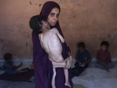 Naeema, una madre palestina de 30 a�os, carga a su hijo Yazan, de 2 a�os, desnutrido, mientras permanecen en su casa da�ada en el campo de refugiados