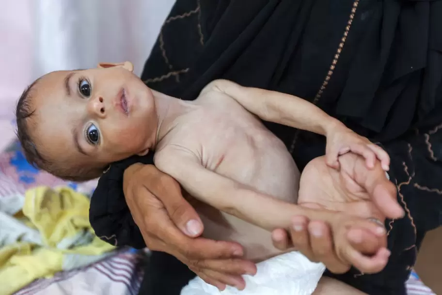 Bebés y madres en Gaza enfrentan desnutrición severa y falta de atención médica (REUTERS/ARCHIVO)