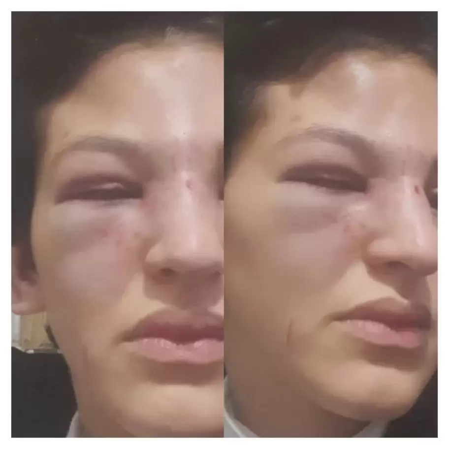 víctima Calilegua
