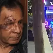 Un hombre fue brutalmente agredido en Perico y pide justicia