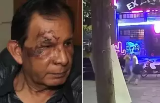 hombre agredido en perico