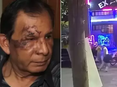 hombre agredido en perico