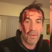 Asaltaron y golpearon a un candidato a senador en Neuqu�n: "Le gatillaron varias veces"