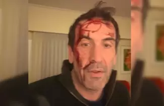 ataque candidato a senador
