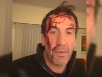 ataque candidato a senador
