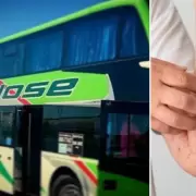 Ocho jujeños viajaban en el colectivo donde se registraron casos de sarampión: cuál es la situación de los pacientes