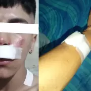 Violento asalto en Libertador: atacaron a un joven e intentaron arrojarlo al r�o