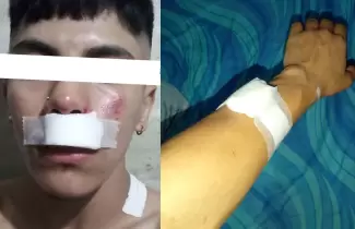 joven atacado en libertador